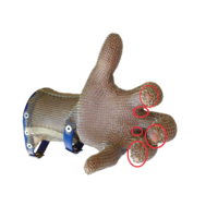 Cuffed Glove Mesh Repair